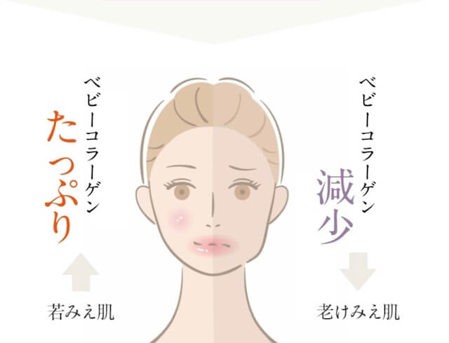 ベビーコラーゲン